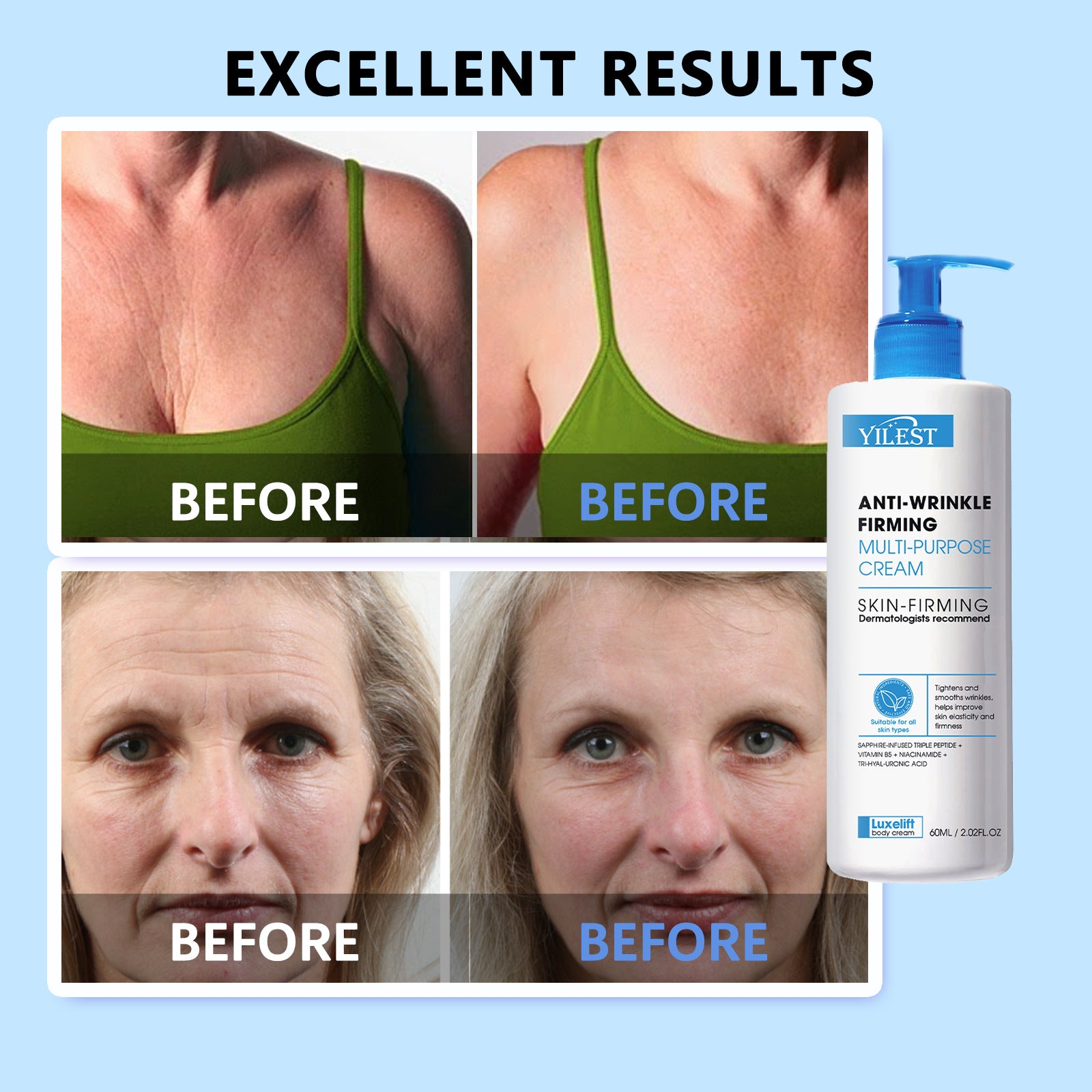 Anti-Wrinkle Skin Cream