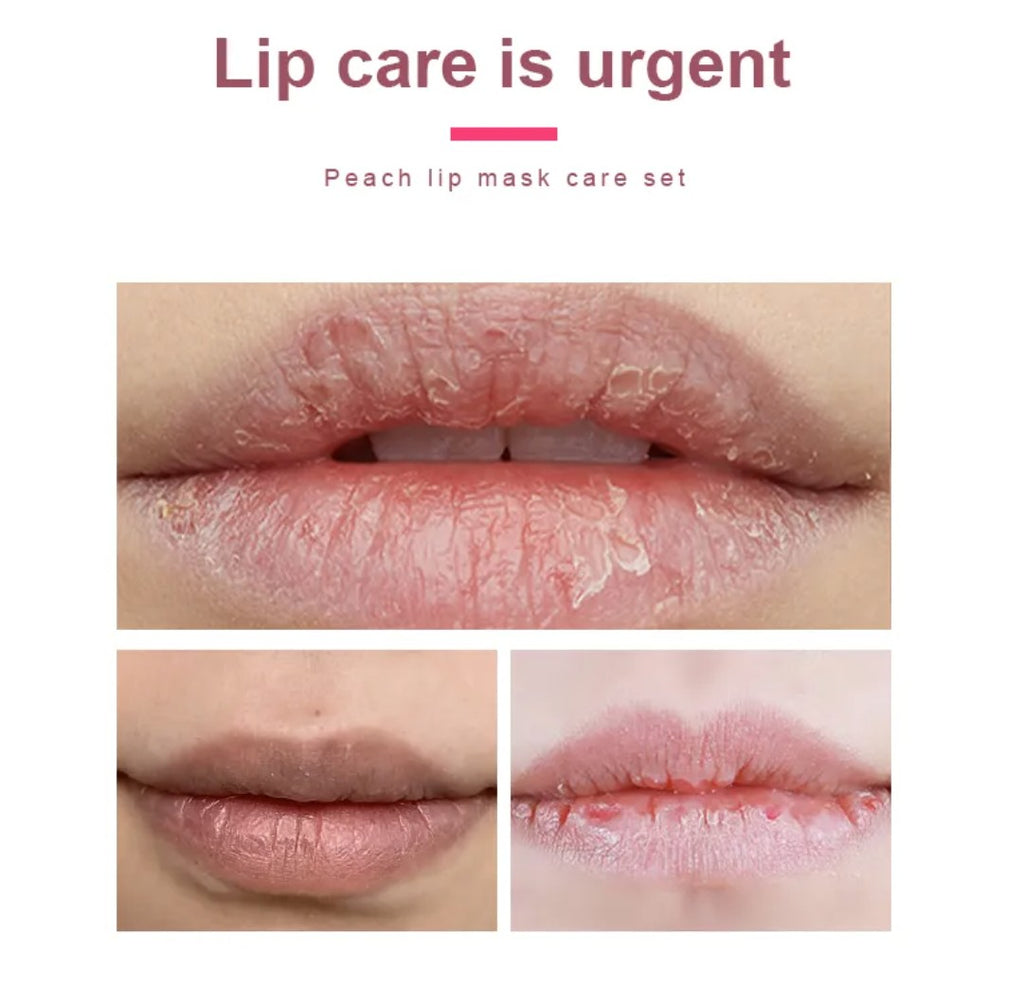 KORMESIC Peach Lip Care Set