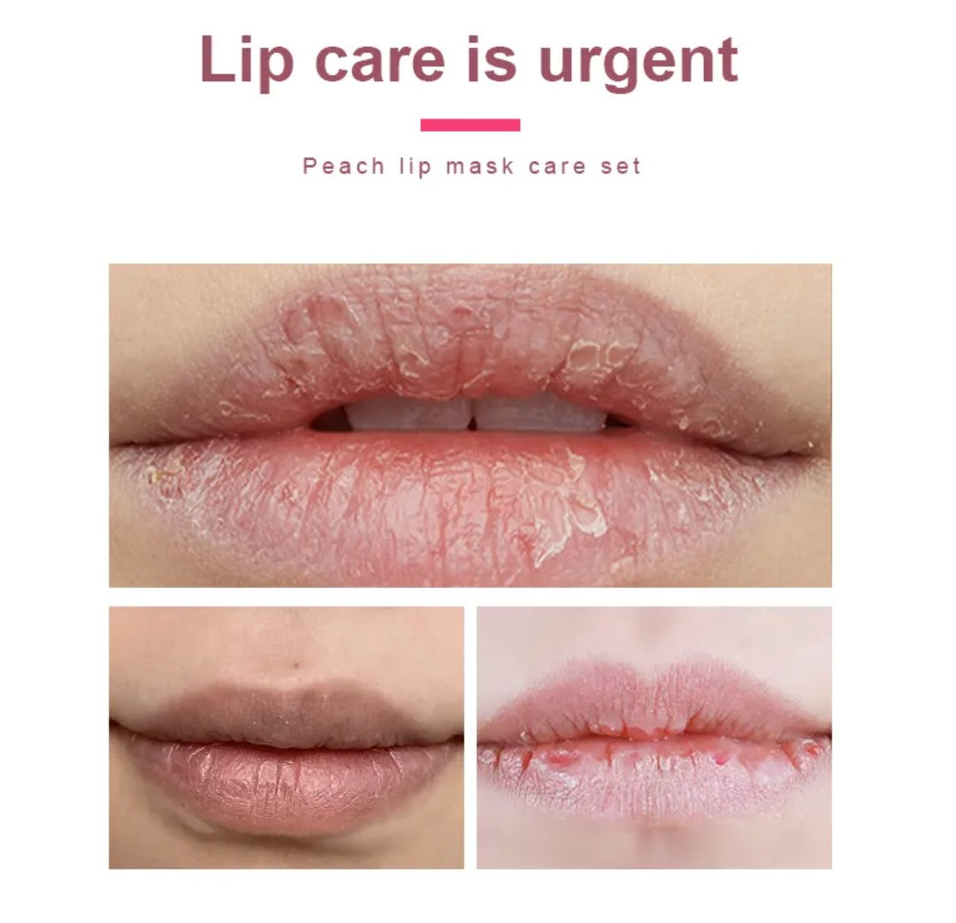 KORMESIC Peach Lip Care Set